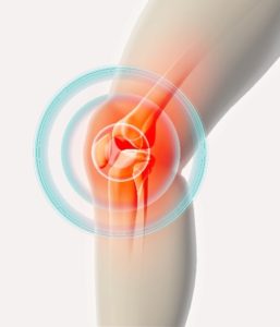 Knee Pain Imaging Chillicothe, OH