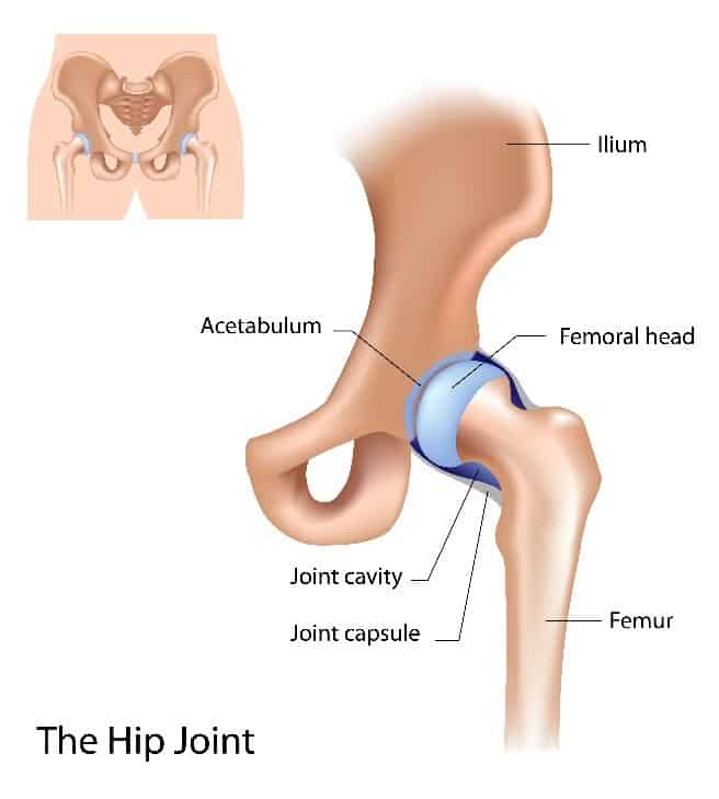 Acetabular Fracture Treatment Chillicothe, OH