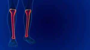 Knee X-Rays for Orthopedic Care