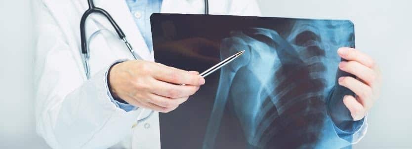Shoulder Pain Procedures Columbus, OH