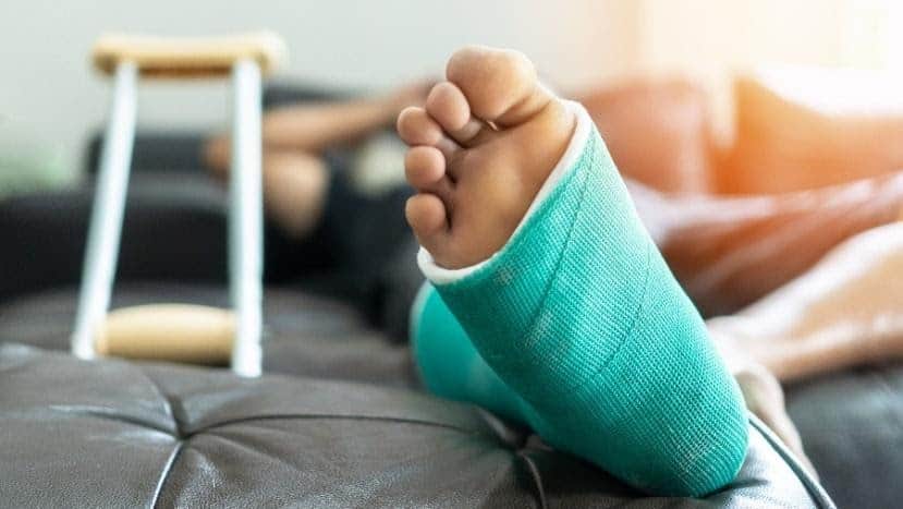 Fracture Fixation Treatment for Columbus & Grove City, OH
