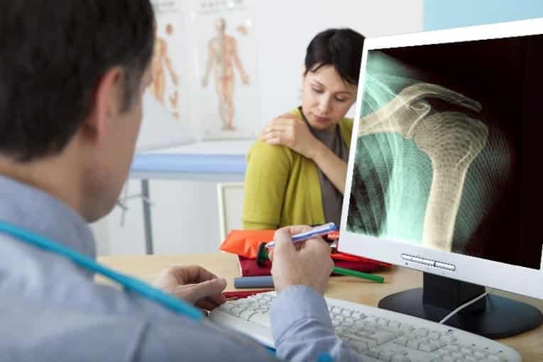 Revision Shoulder Replacement for Columbus & Grove City, OH patients